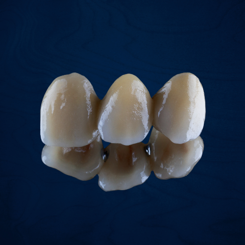 Tooth Crown